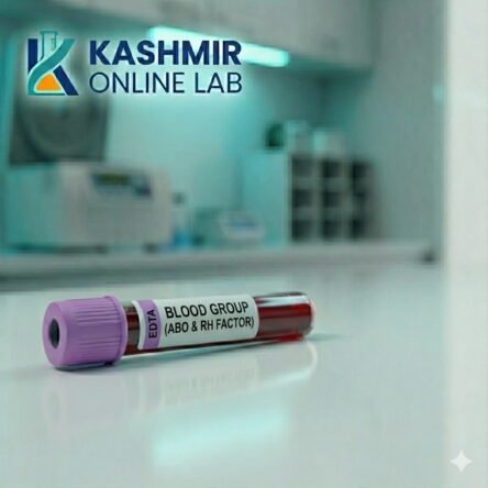 Blood Group (Abo & Rh Factor)