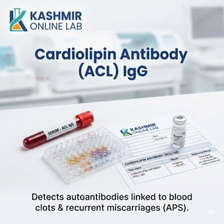 Cardiolipin Antibody Acl-Igg Antibody