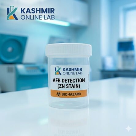 Afb Detection (Zn Stain)