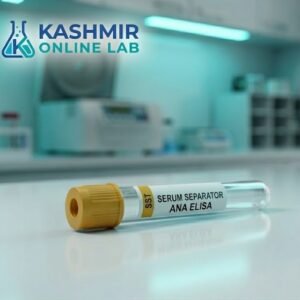 Chlamydia Trachomatis Igg Antibody