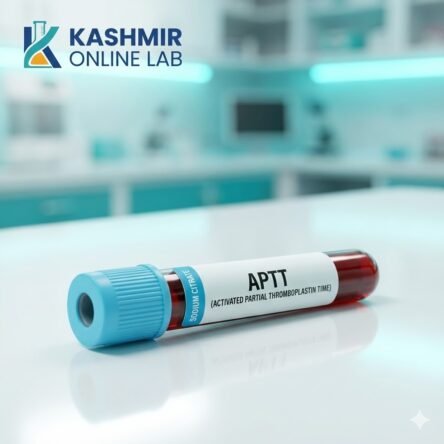 Activated Partial Thromboplastin Time (Aptt)