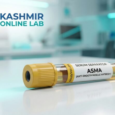 Asma (Anti Smooth Muscle Antibody)