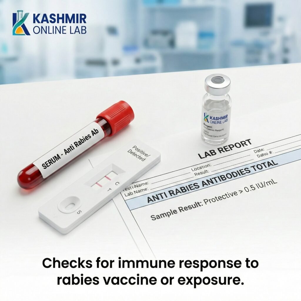 Anti Rabies Antibodies Total - Kashmir Online Laboratory