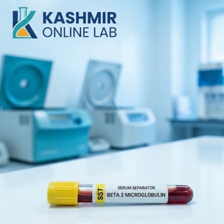 Beta 2 Microglobulin Serum