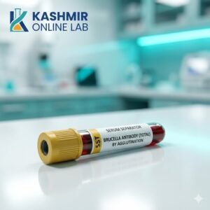 Brucella Antibody-Infectious Diseases