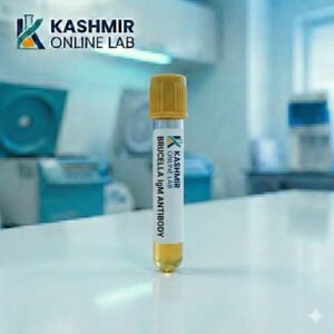 Brucella Igm Antibody Serum