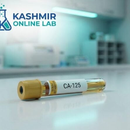 Ca-125