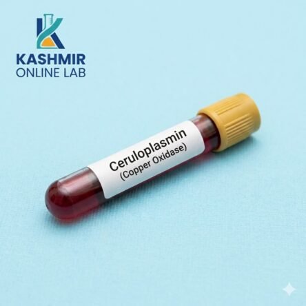 Ceruloplasmin (Copper Oxidase)