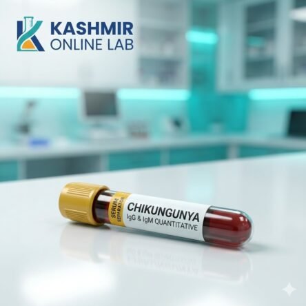 Chikungunya Igg & Igm Quantitative