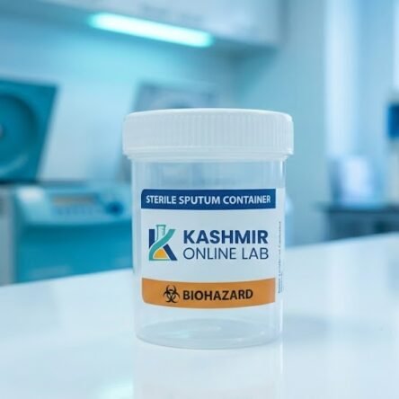 Acid Fast Susceptibility – 5 Drugs (Bactec)