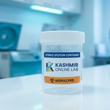 Acid Fast Susceptibility – 10 Drugs (Bactec)