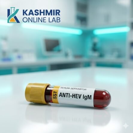 Anti Hepatitis E Virus (Anti Hev) – Igm
