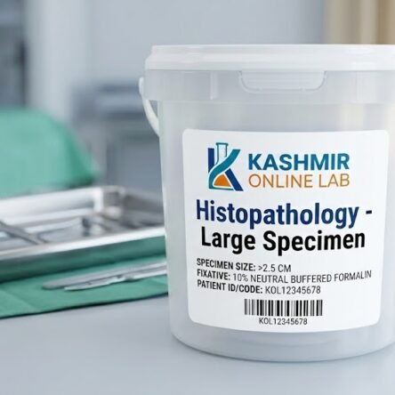 Biopsy Large (>2.5 Cm)