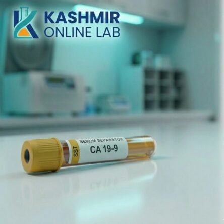 Carbohydrate Antigen 19-9 (CA 19-9)