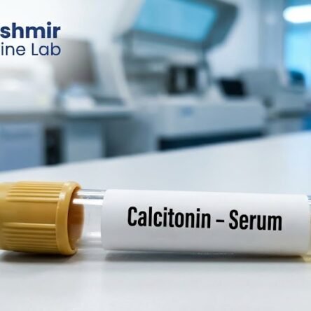 Calcitonin – Serum