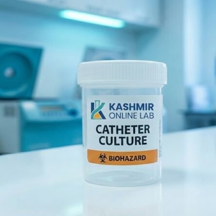 Catheter Culture