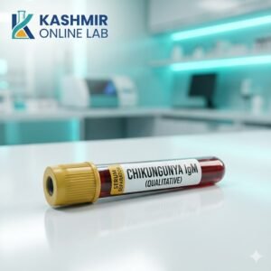 Chikungunya Igm (Qualitative)