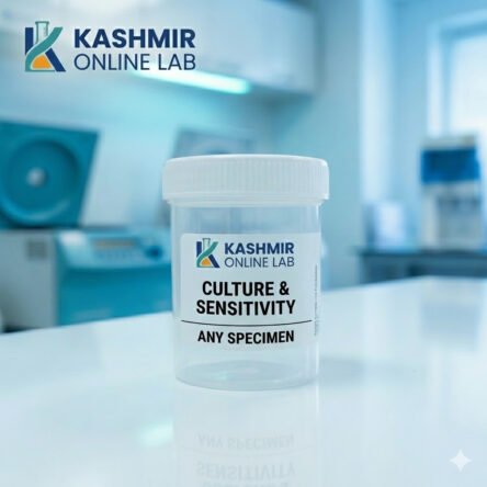 Any Specimen For Culture And Sensitivity