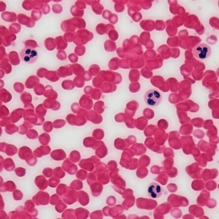 Blood Picture (P/S) Gbp