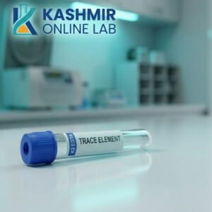 Cadmium - Urine Random