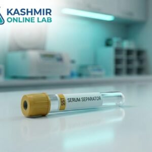 TORCH-4 IgM Panel, Serum (ELISA)