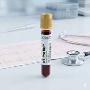 NT-Pro BNP Test