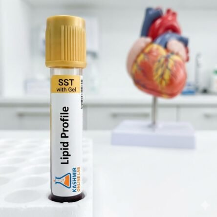 Lipid Profile / Lipid Panel