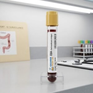 CEA (Carcinoembryonic Antigen) - Tumor Marker