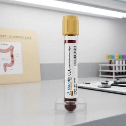 CEA (Carcinoembryonic Antigen) – Tumor Marker