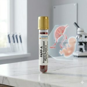 PAPP-A (Pregnancy-Associated Plasma Protein-A)