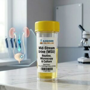 Mid-Stream Urine (MSU) - Routine, Microscopy & Culture