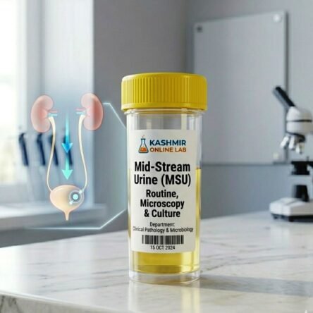 Mid-Stream Urine (MSU) – Routine, Microscopy & Culture